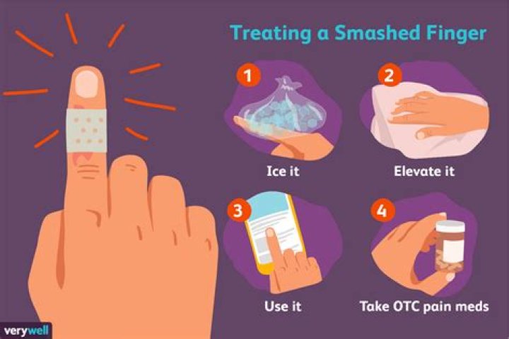 What should I do if I smashed my finger in a door?